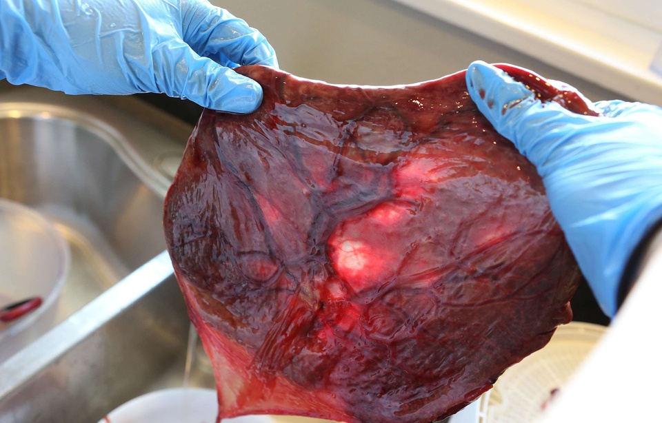 Monaco: Plusieurs milliers de pots de crème avec du placenta humain saisis